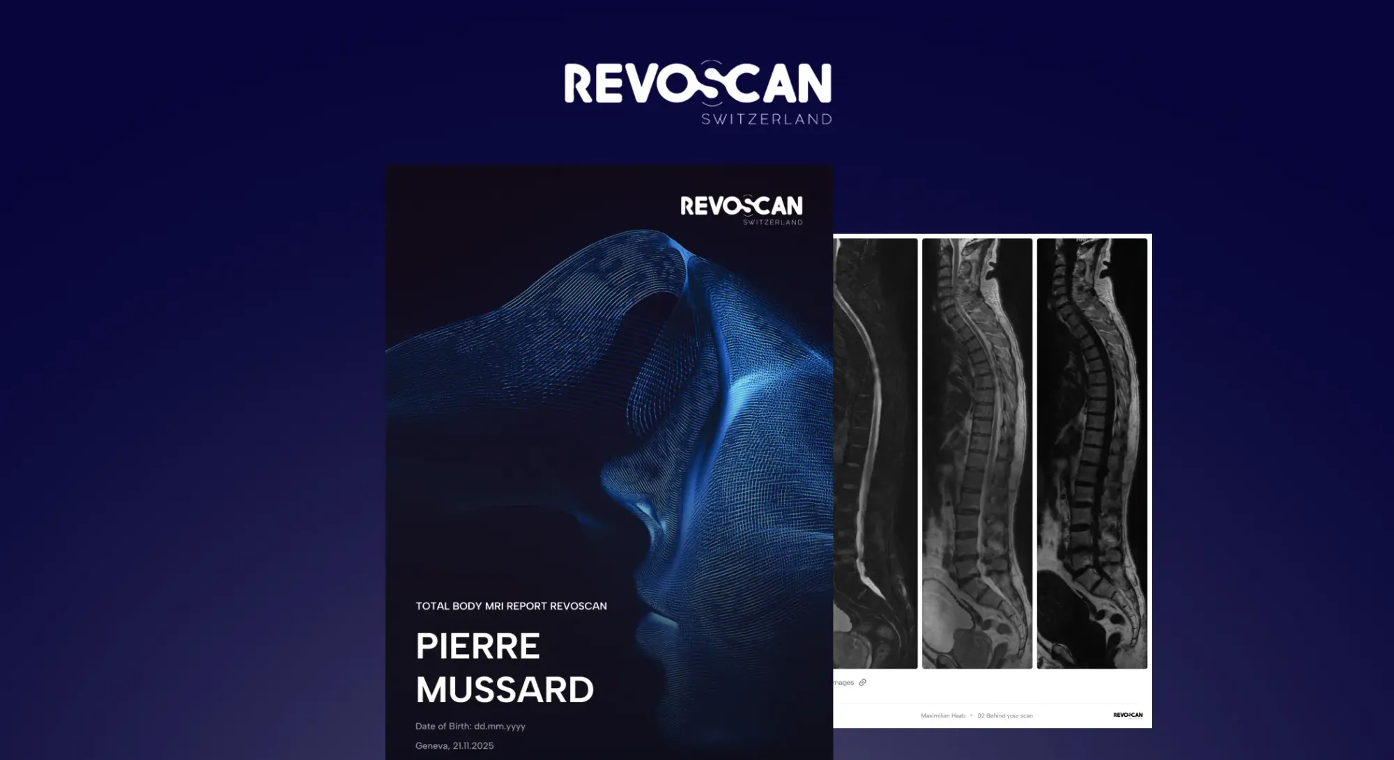 screens from the PDF report of revoscan