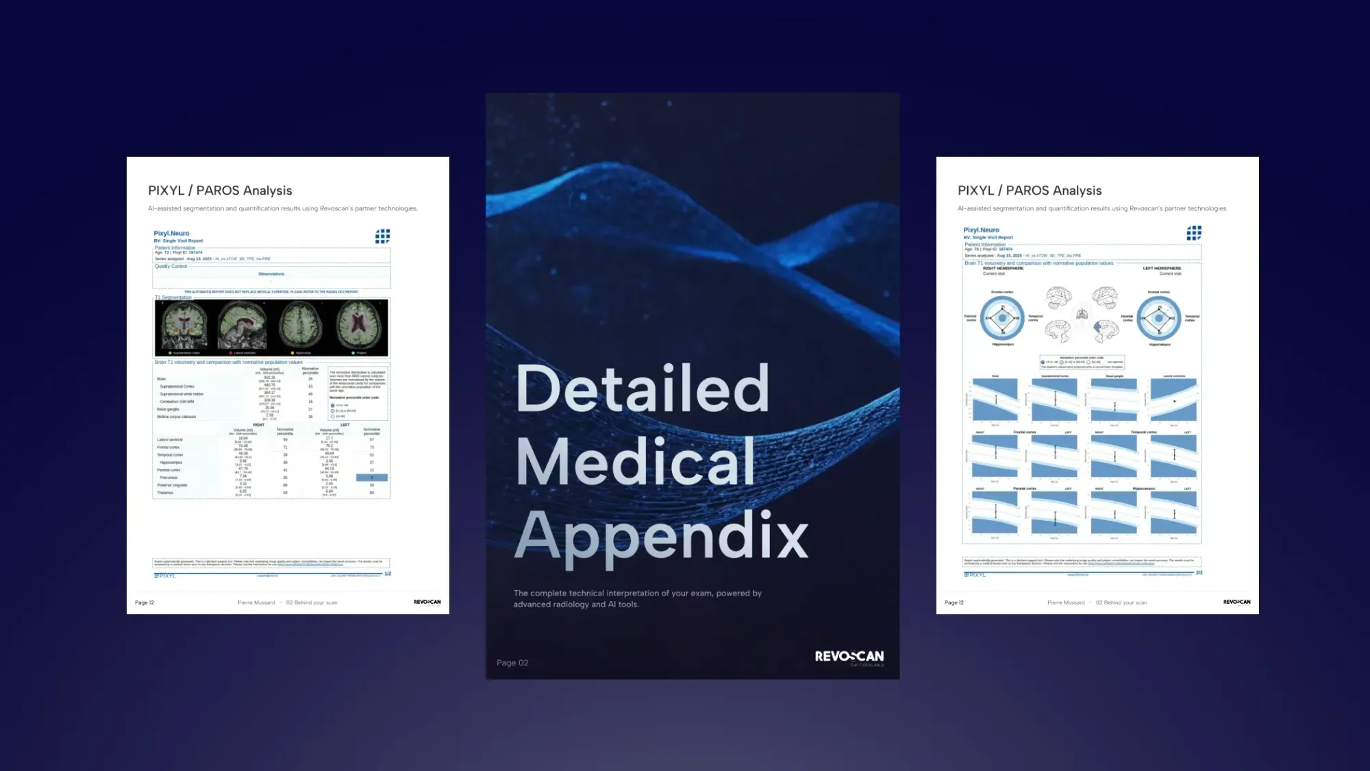 screens from the PDF report of revoscan