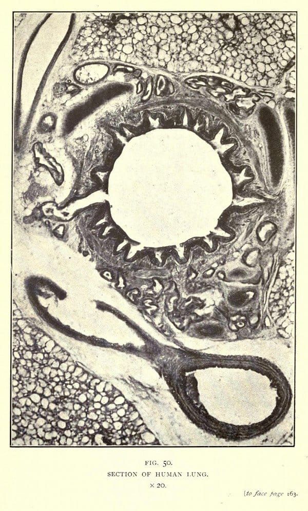 Farmer's Lungs (NaPoWriMo Day 15)