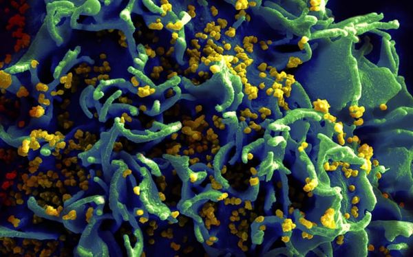 Scientists believe they may have found a cure for HIV/AIDS