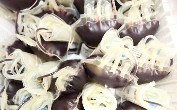 Gay and bisexual men will be excluded from donating blood plasma in coronavirus trials