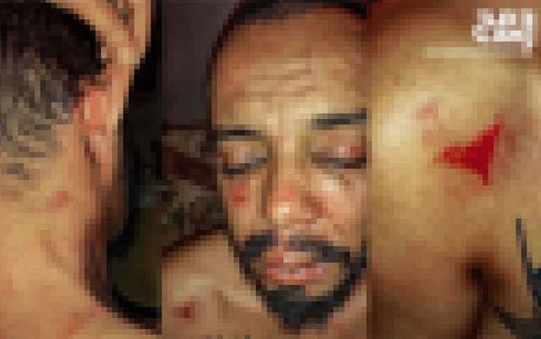 Tunisian LGBTQ+ activist ‘brutally beaten by police officers’ in violent attack