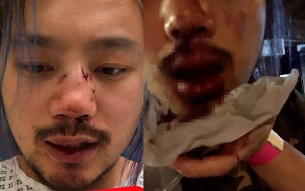 Cardiff student violently beaten in a suspected homophobic hate crime