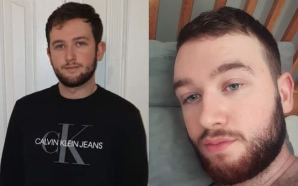 Gay rugby player left with fractured eye socket after brutal homophobic attack