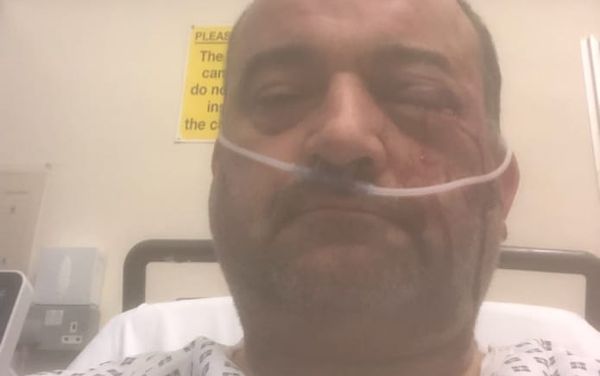 Gay man almost blinded after ‘unprovoked hate crime’ in Birmingham