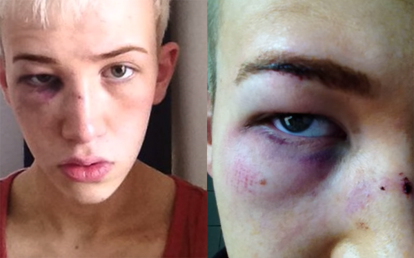 Victims of brutal homophobic attack left “disgusted” after police comment