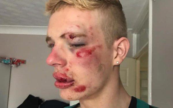 Gay man brutally attacked by homophobes outside McDonald’s