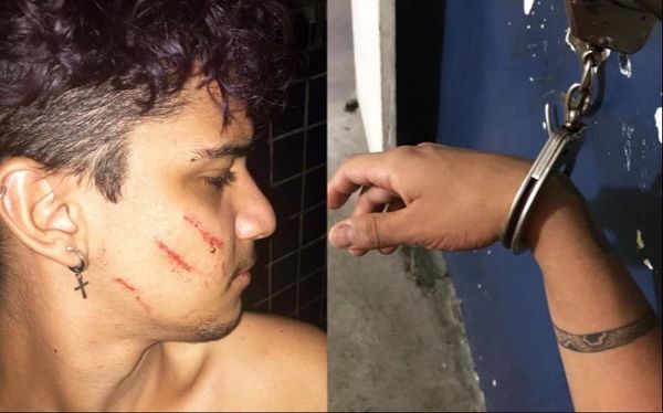 Gay Brazilian man beaten by neighbours and then arrested by police