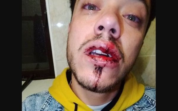 Dublin man attacked by a gang with steel bars after kissing his boyfriend