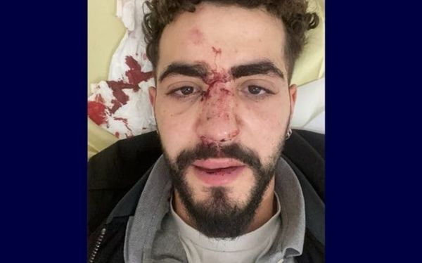 Gay Frenchman beaten by Uber driver after he found out about his sexuality