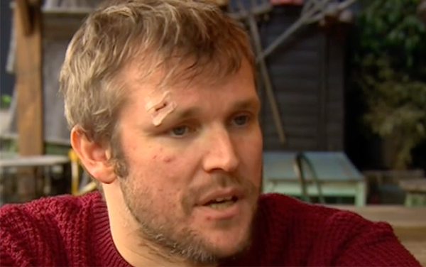 Birmingham man viciously “bashed” with wine bottle in homophobic attack