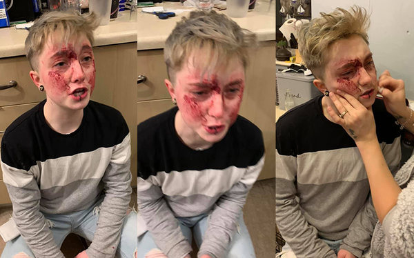 Lesbian punched and thrown to the ground in violent homophobic attack