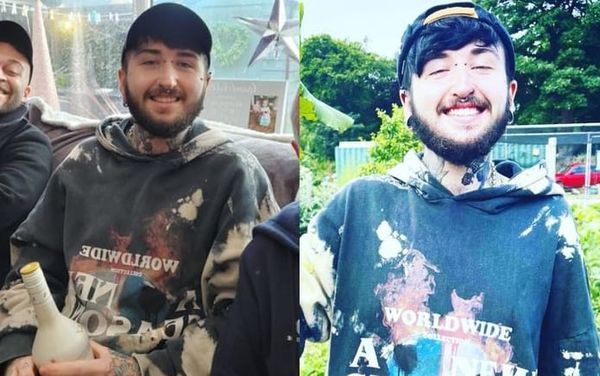 Gay man suffers horrific injuries after violent homophobic attack in Manchester