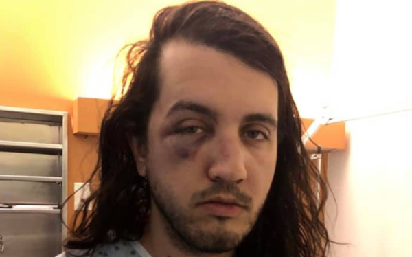 Canadian fashion designer and boyfriend attacked in suspected homophobic assault