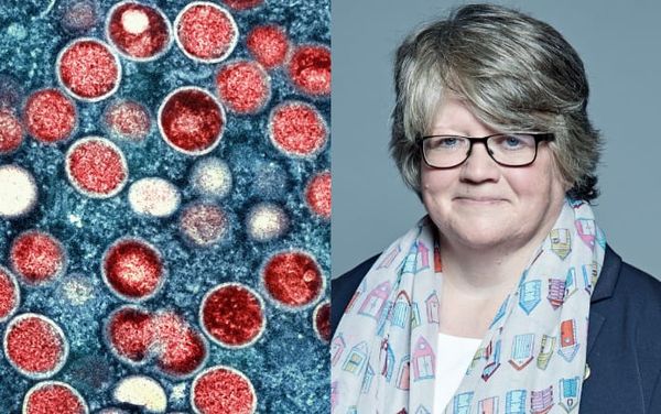 Monkeypox outbreak needs to be a priority, charities warn UK government