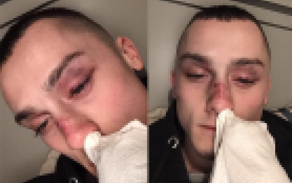 Gay couple ‘beaten and robbed’ by gang in violent attack