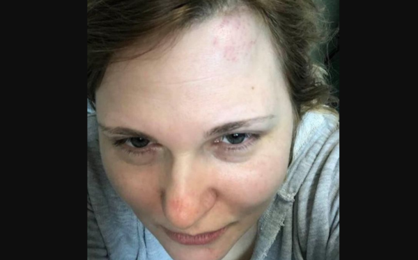 Journalist who first reported gay purge in Chechnya attacked in Grozny