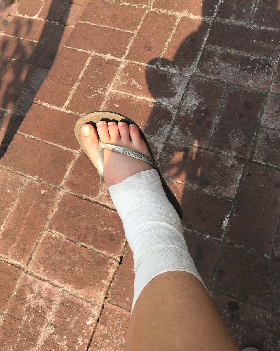 How to recover from a sprained ankle 5 trail and kale