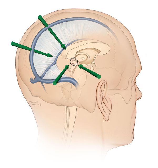 #041 How your goals are stopping you from achieving your goals