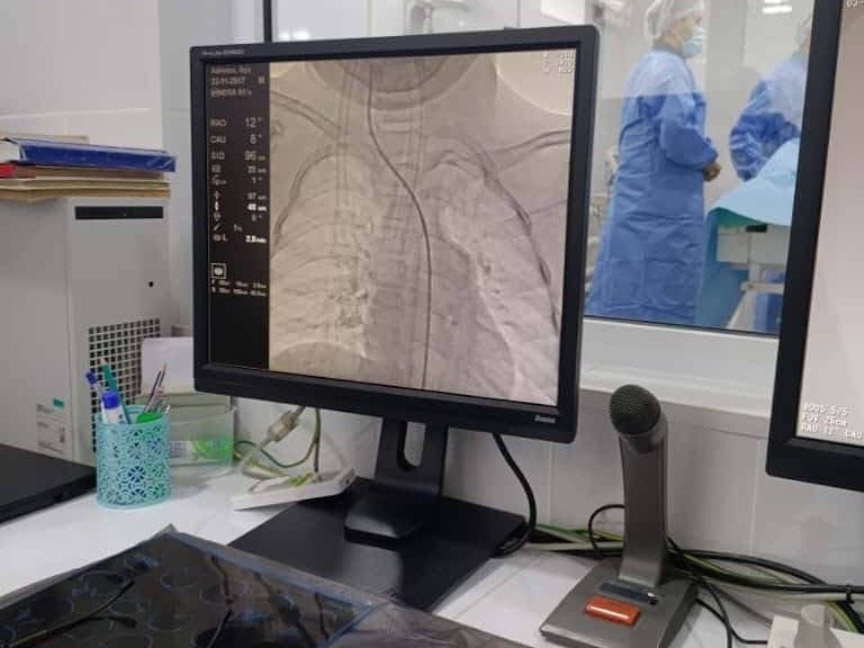 Кыргызстанда балдарга татаал нейрохирургиялык операциялар жасалды