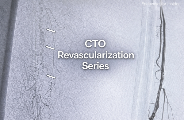 CTO REVASCULARIZATION