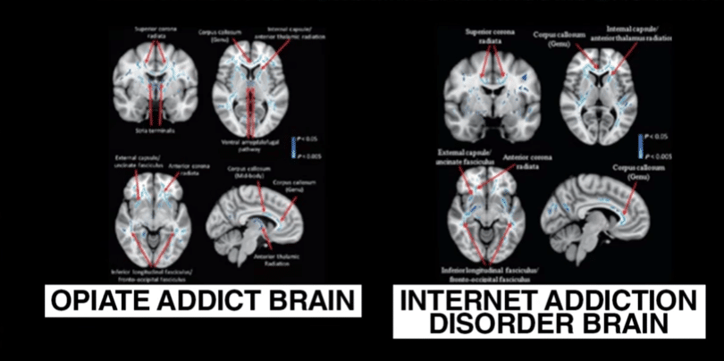Teknoloji Bağımlılığı Nedir? Beyni nasıl etkiler?