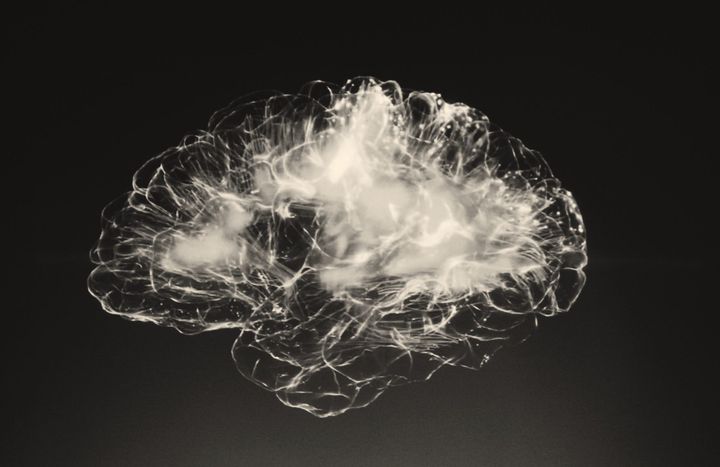 New study of Moyamoya - a rare disease in the brain vessels