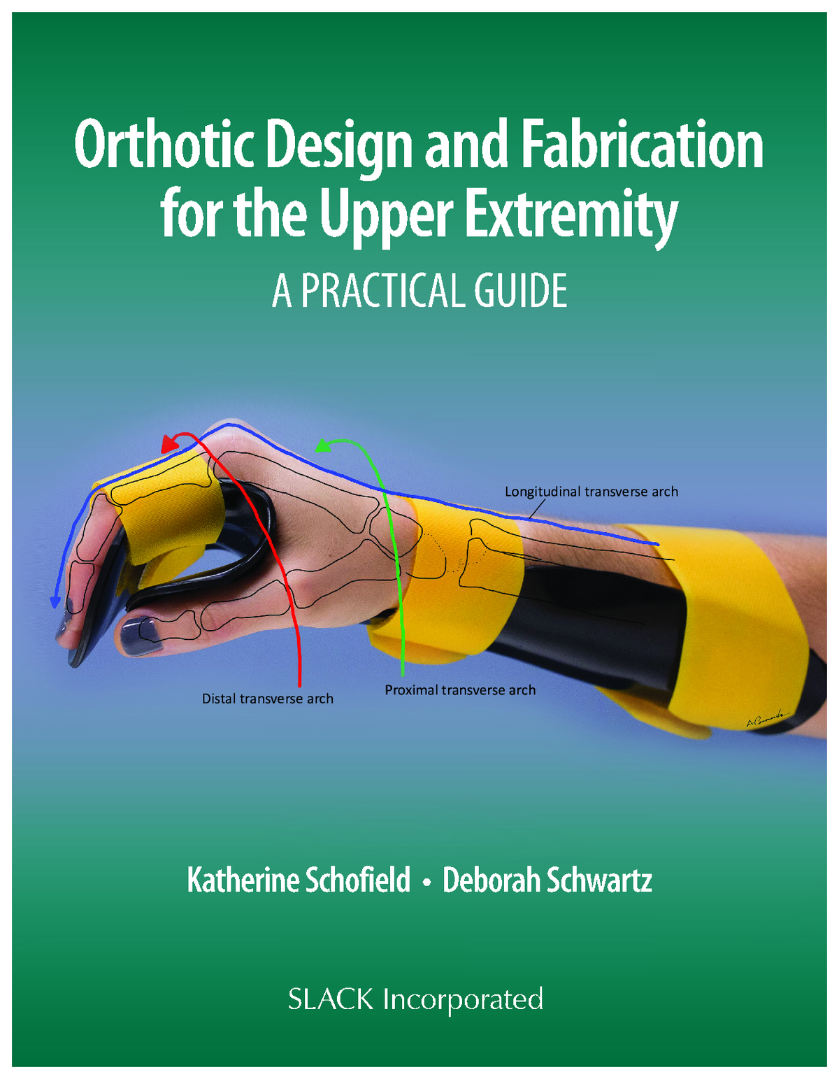 [eTextBook] [PDF] Orthotic Design and Fabrication for the Upper Extremity A Practical Guide 1st Edition By Katherine Schofield, Deborah Schwartz (All Chapters, 100% Original Verified, A+ Grade)