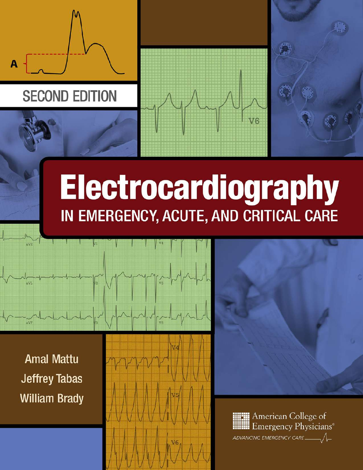 eBook EPUB PDF Electrocardiography in Emergency, Acute, and Critical Care 2nd Edition By Amal Mattu, FACEP