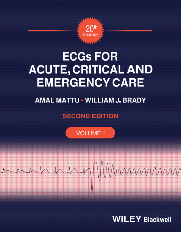 eBook ECGs for Acute, Critical and Emergency Care (Volume 1) 20th Anniversary 2e Amal Mattu, William Brady