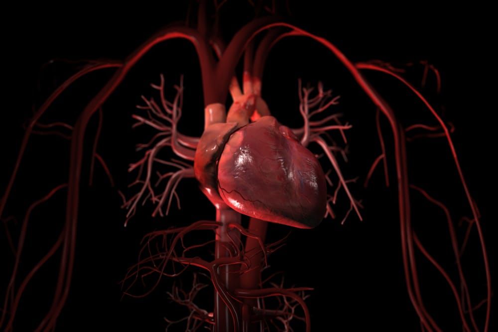 Can Someone Have Wildly High LDL Cholesterol and Zero Plaque?