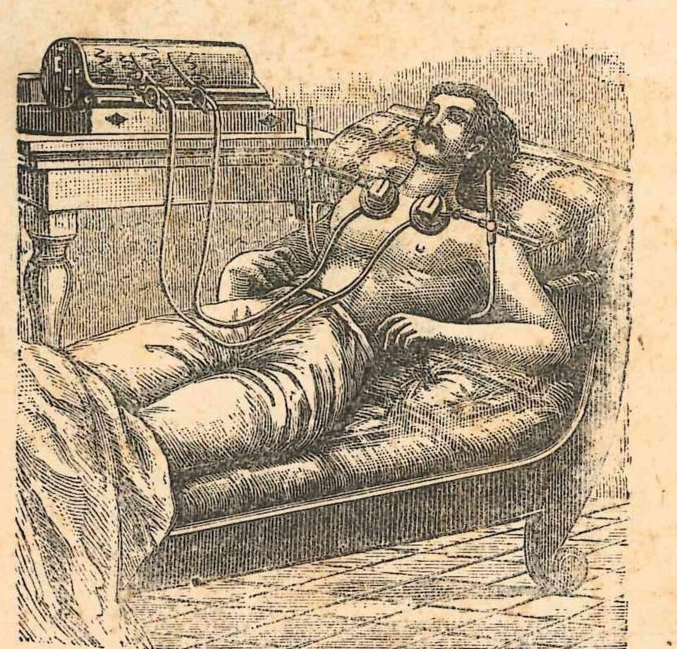 Historical illustration of a patient connected to early cardiac monitoring equipment.
