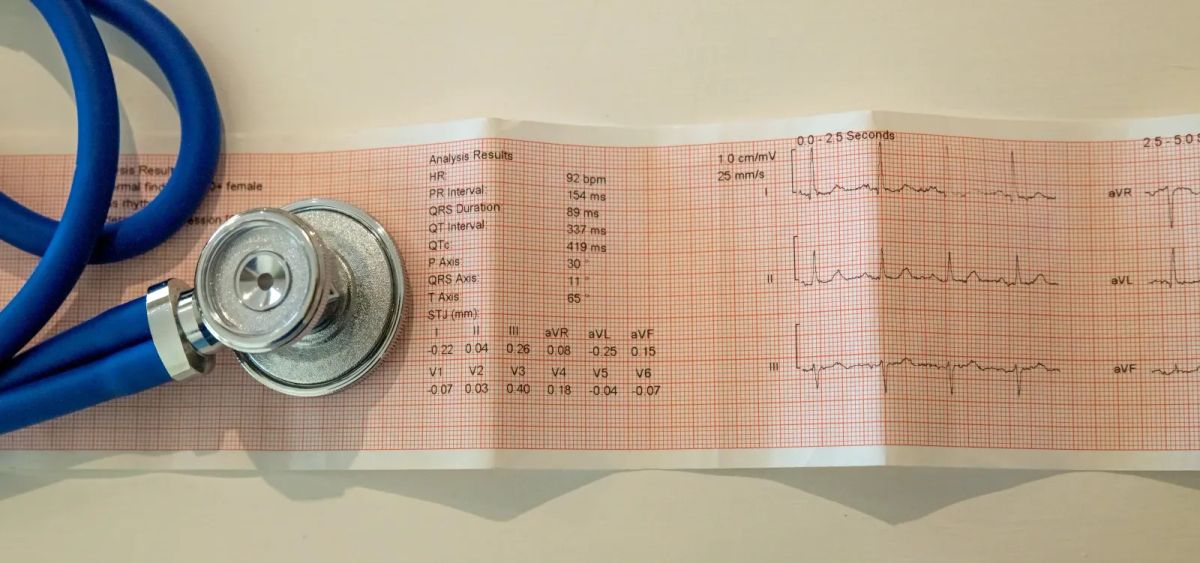 ECG printout with a stethoscope, representing heart attack recognition and emergency response.