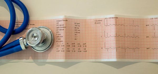 ECG printout with a stethoscope, representing heart attack recognition and emergency response.