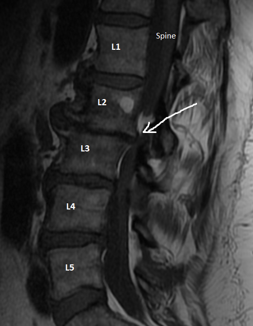 Chcback2016 Chcback2016