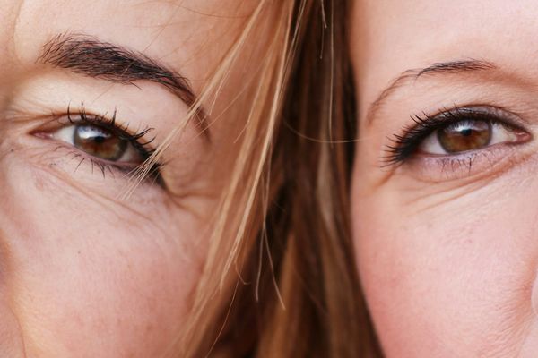 HA Fillers vs Collagen Stimulators – How to Choose