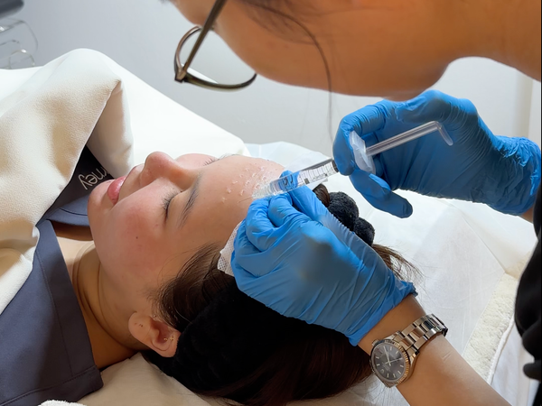 Skinbooster treatment