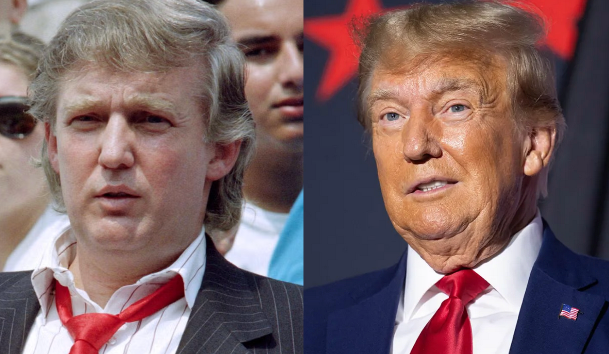 What Causes Dementia?