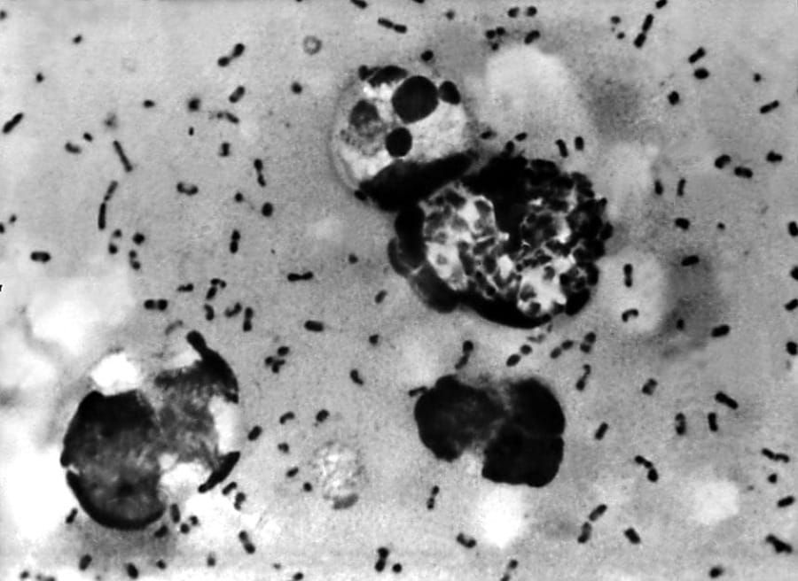 Russia keeps plague lab samples from WHO as dead technician's mother says 'they destroyed her'