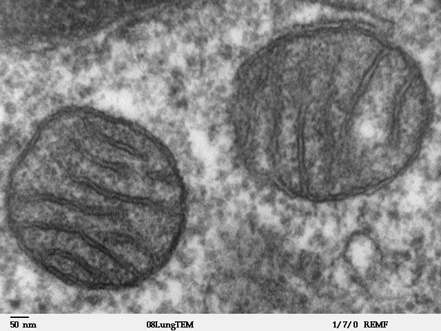 Electron micrograph of mitochondria inside a cell.