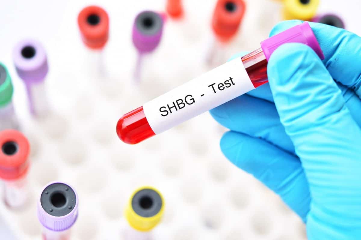 SHBG sportaši slobodni testosteron biokemijska optimizacija SHBG referentne vrijednosti dr. Predrag Jakovljević anabolička rezistencija tumačenje nalaza krvi