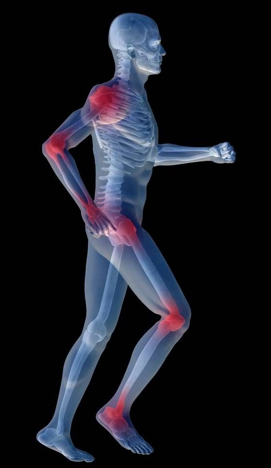 Koje prehrambene namirnice smanjuju a koje povećavaju upalu?