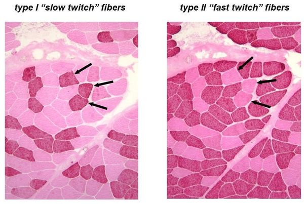 amonijak u sportu Tip 2x vlakna brza mišićna vlakna purinski nukleotidni ciklus centralni umor medicina sporta biomehanika pl