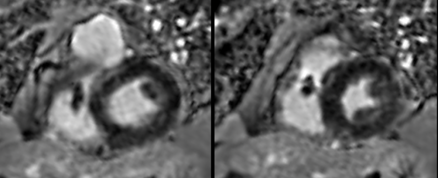 CMR scanning with devices