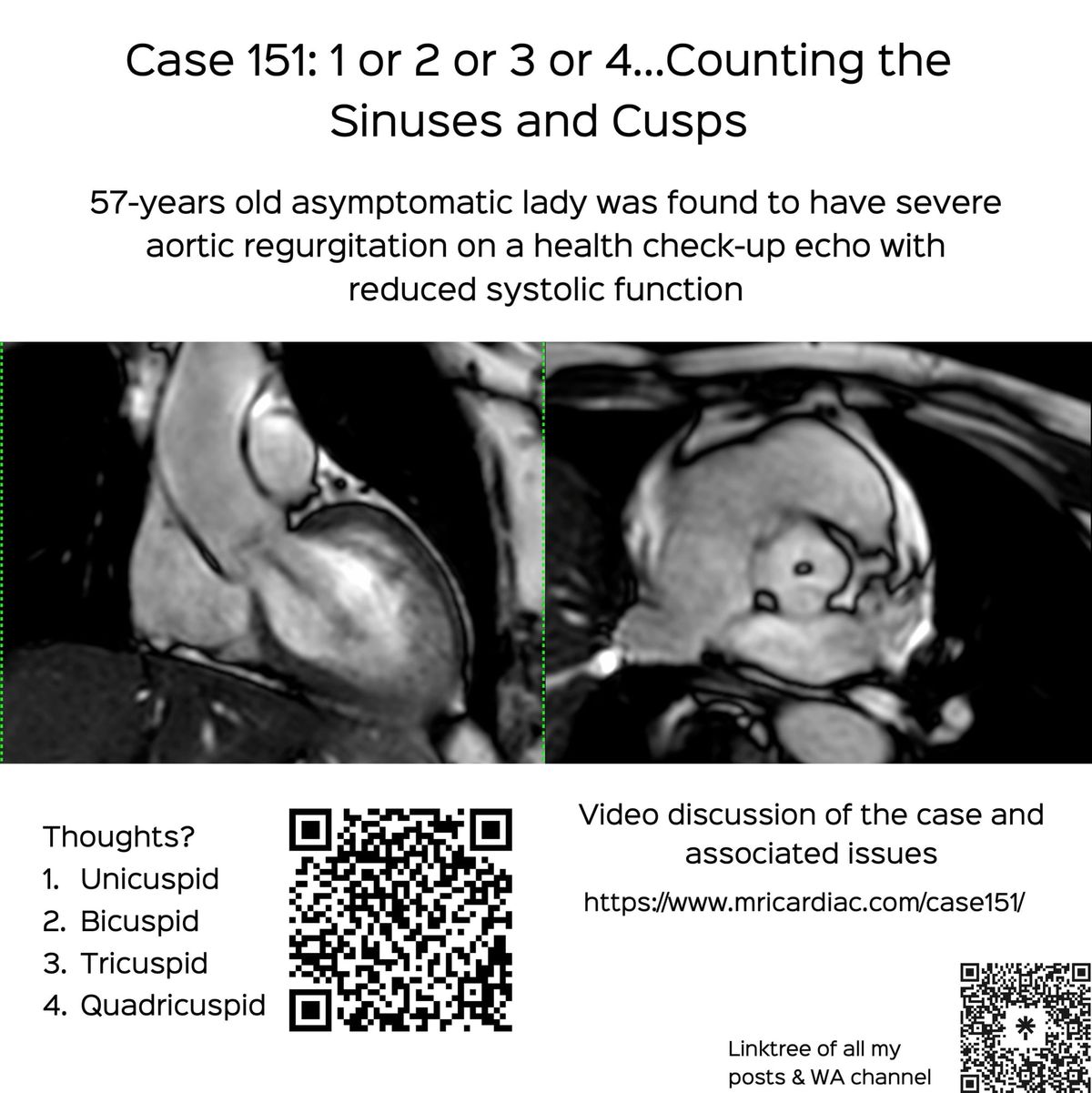 Case 151: 1 or 2 or 3 or 4…Counting the Sinuses and Cusps