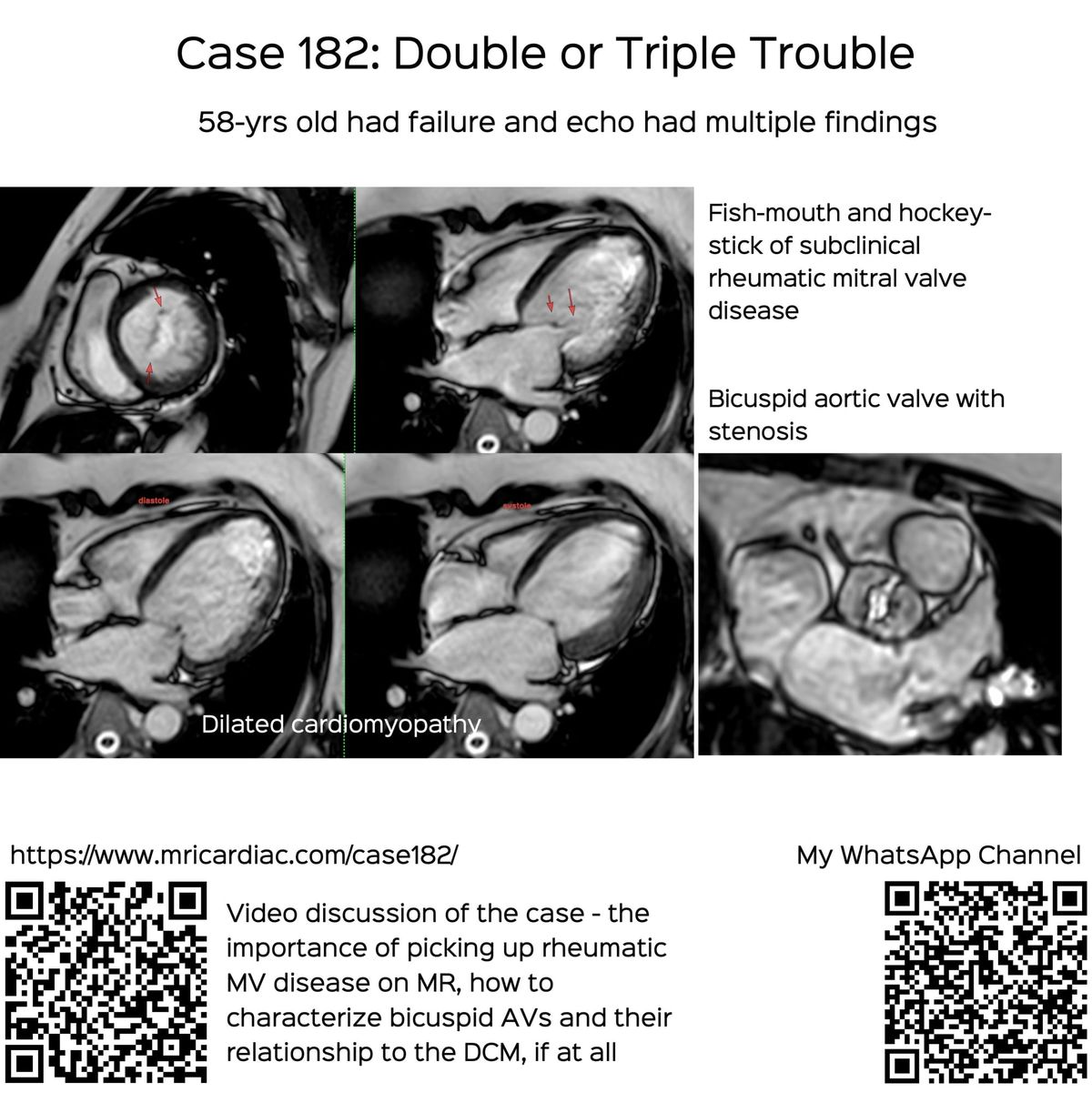 Case 182: Double or Triple Trouble
