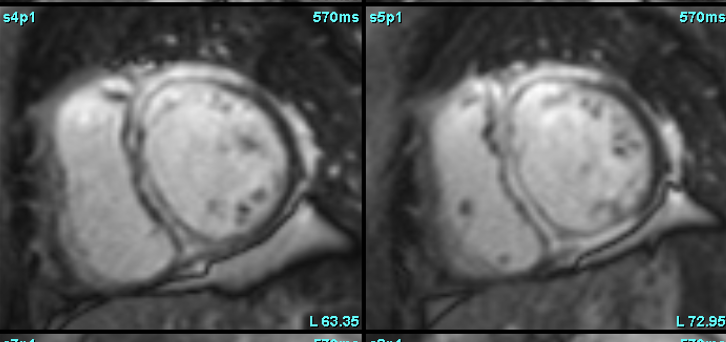 CMR decoding pathology!