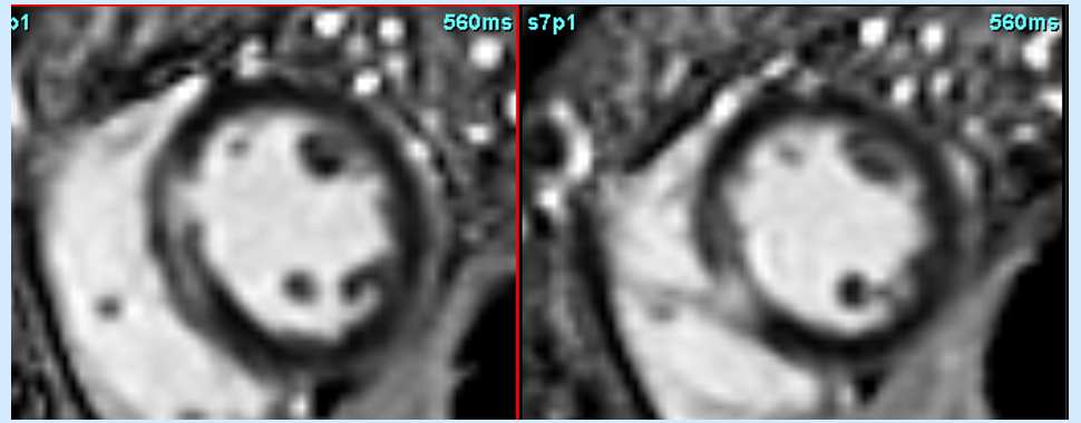 Heart-Gut connection