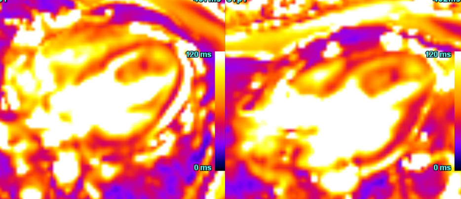 Uncommon presentation: Common pathology