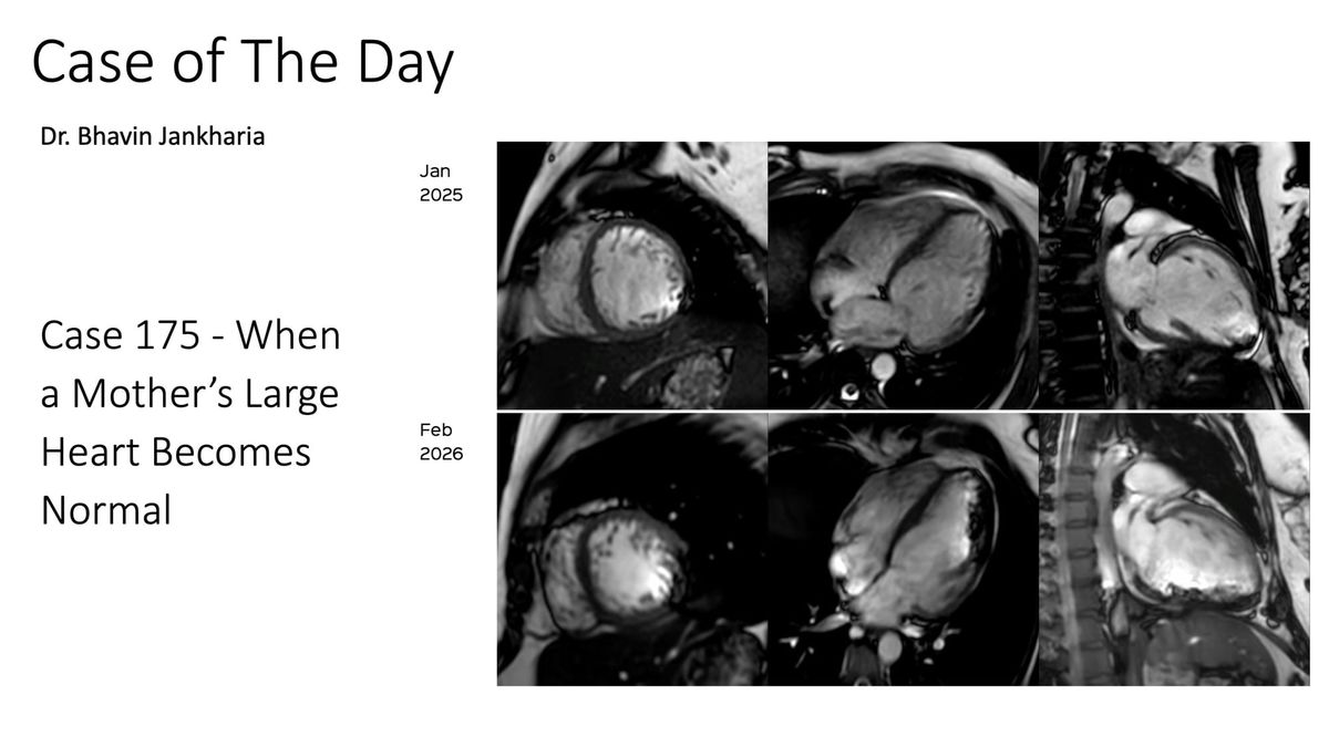 COD 175 - When a Mother’s Large Heart Becomes Normal